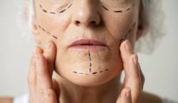 20245 04 14 Qué es una armonización facial (1)